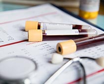 SWAN Investigators Publish Article about Predicting the Timing of Final Menstrual Period